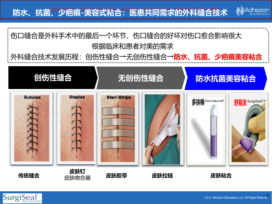 医用粘合剂产品介绍ppt课件_第1页