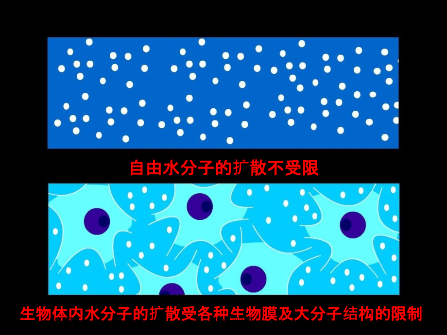 磁共振DWI的应用培训课件_第1页