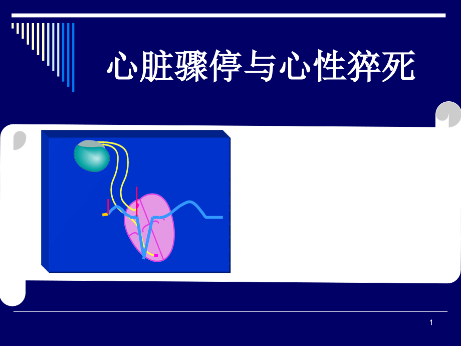 心脏骤停与心源性猝死课件_第1页