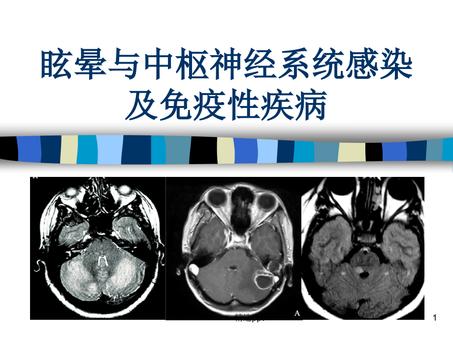 眩晕与中枢神经系统感染及免疫性疾病课件_第1页