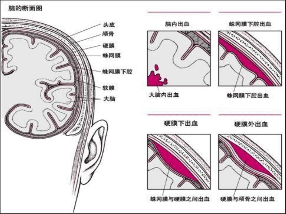 神经外科常见引流管的管理课件_第1页