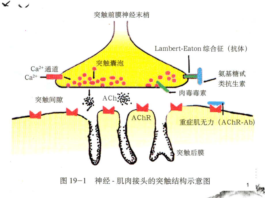 眼肌型重症肌无力治疗进展课件_第1页