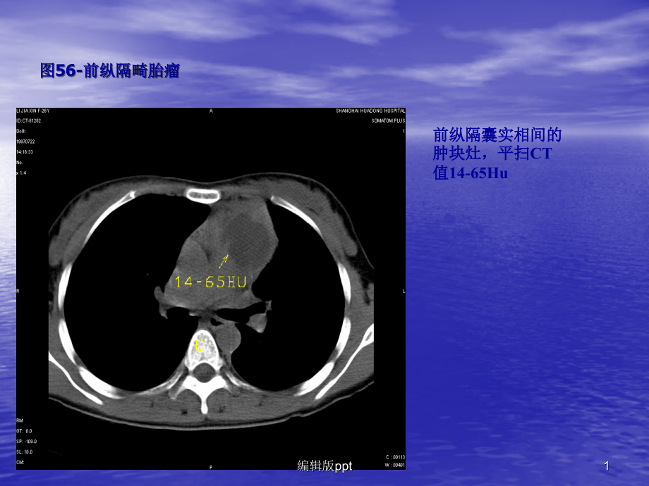 胸部ct-2教学讲解课件_第1页