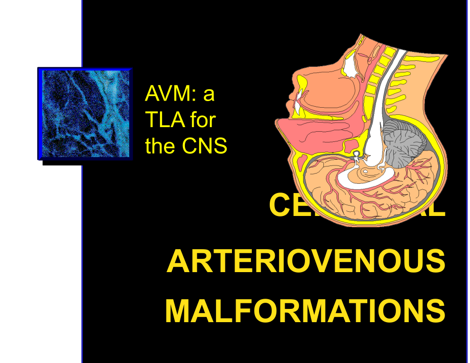 脑动静脉畸形--医药类课件1_第1页