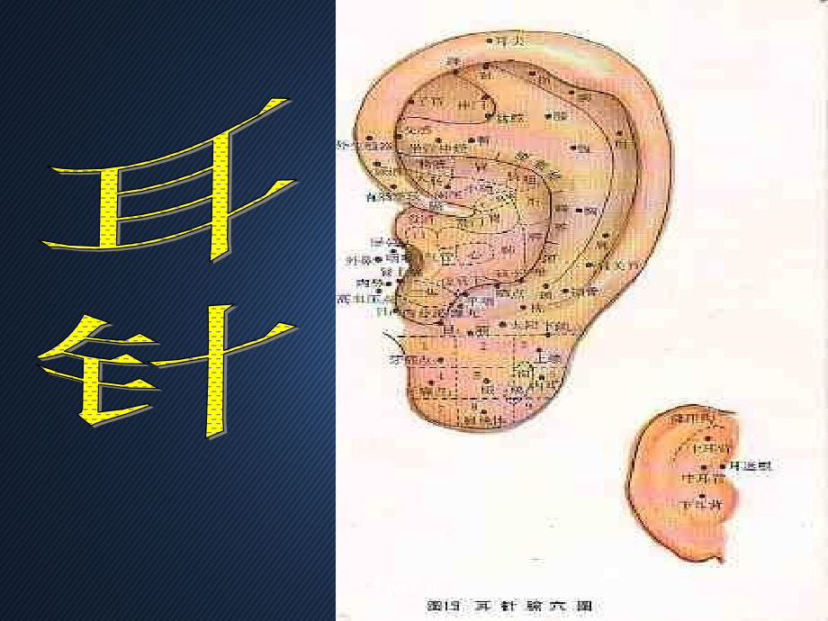 耳针疗法--课件_第1页