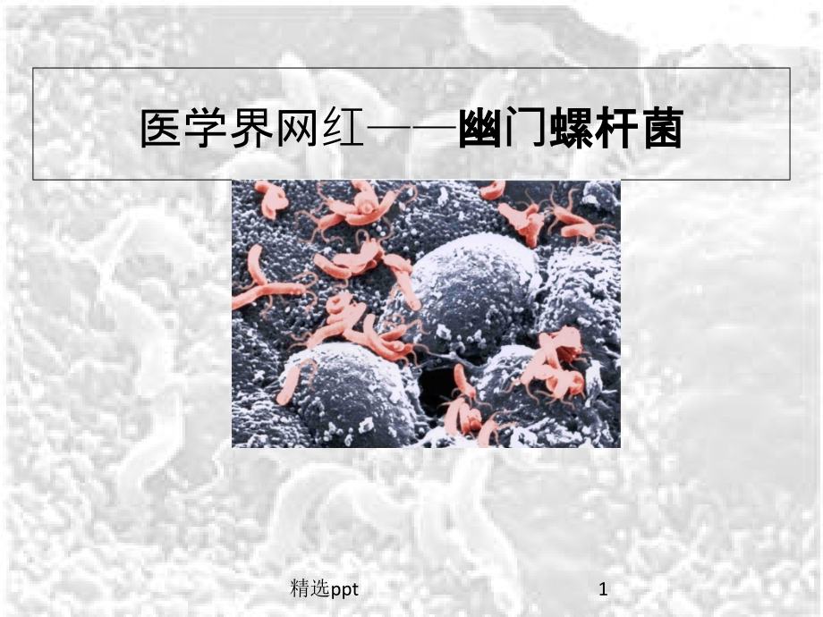 幽门螺杆菌检测方法课件_第1页