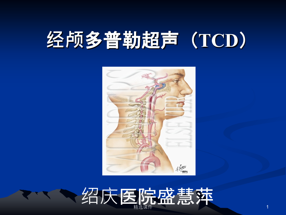 经颅多普勒(TCD)讲解07517课件_第1页