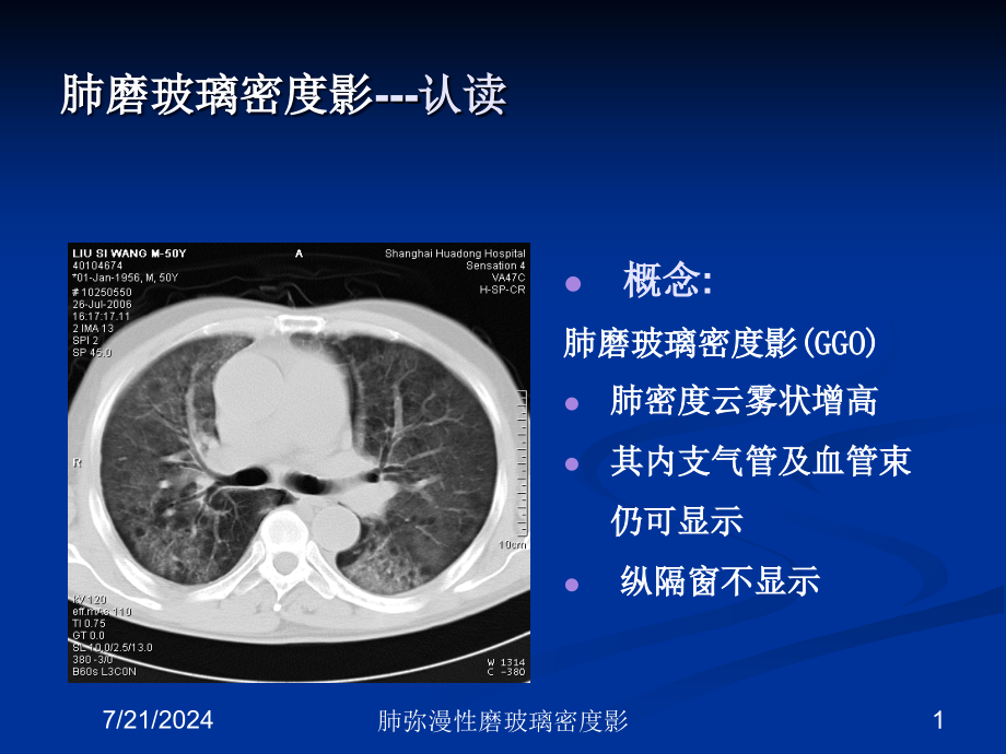 肺弥漫性磨玻璃密度影培训课件_第1页