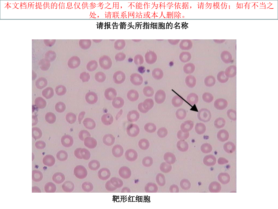 血涂片图谱专题知识讲座培训课件_第1页