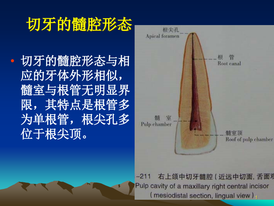 下颌侧切牙髓腔形态课件_第1页