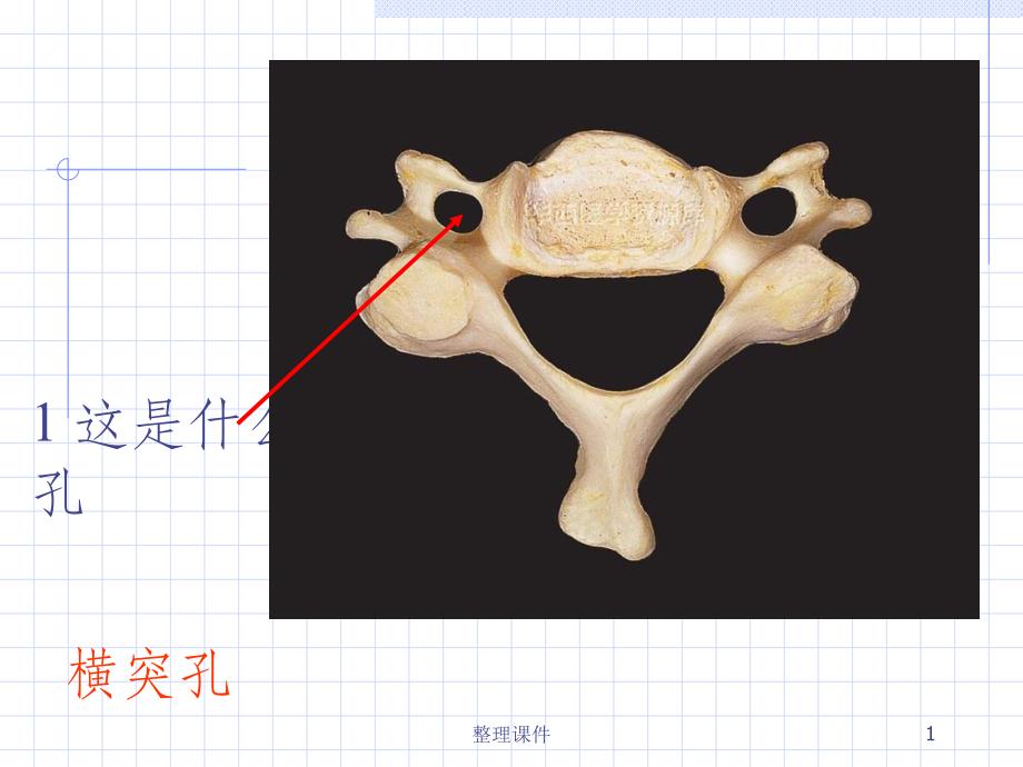 解剖标本考试课件(同名1824)_第1页