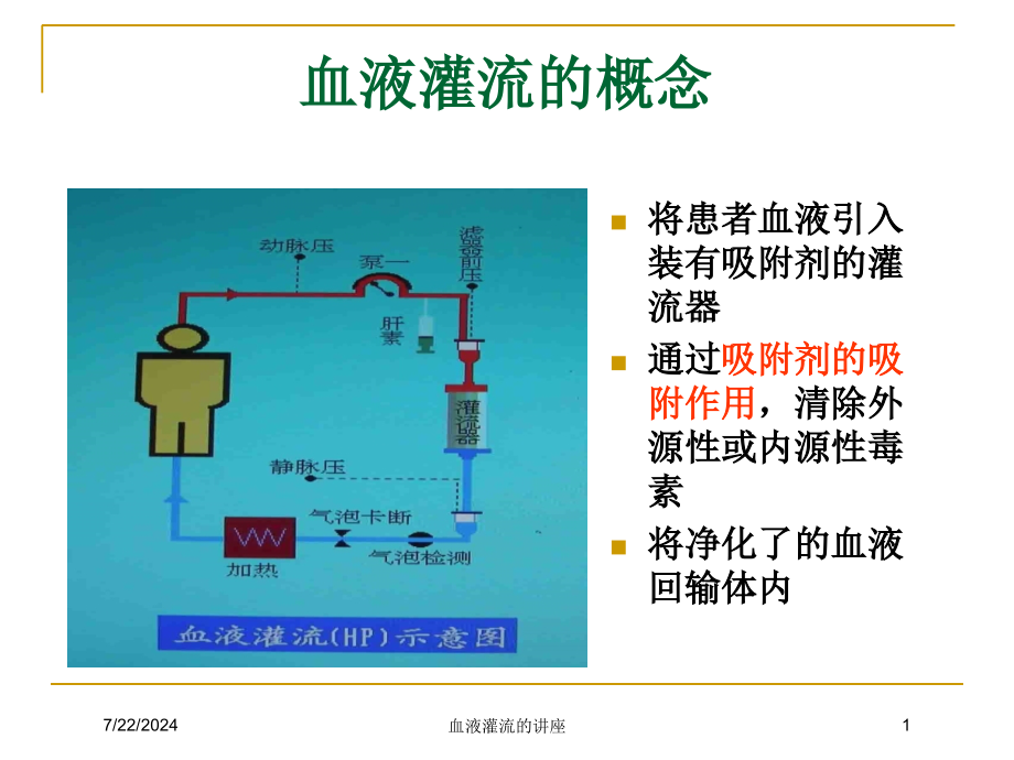 血液灌流的讲座培训课件_第1页