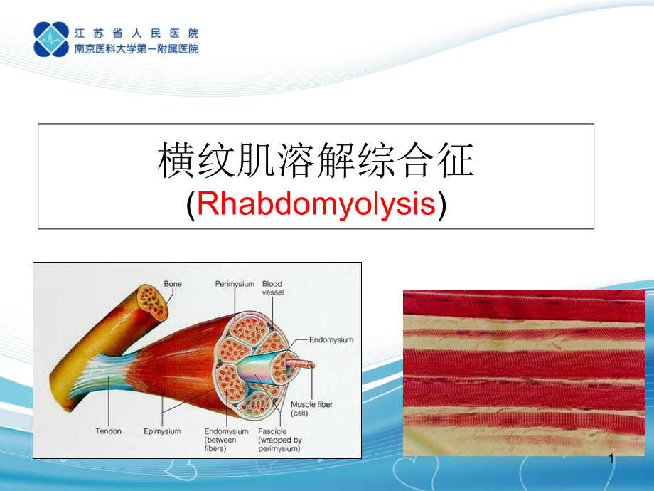 横纹肌溶解综合征课件_第1页