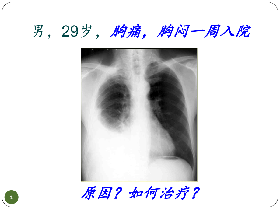 胸膜疾病讲课课件_第1页