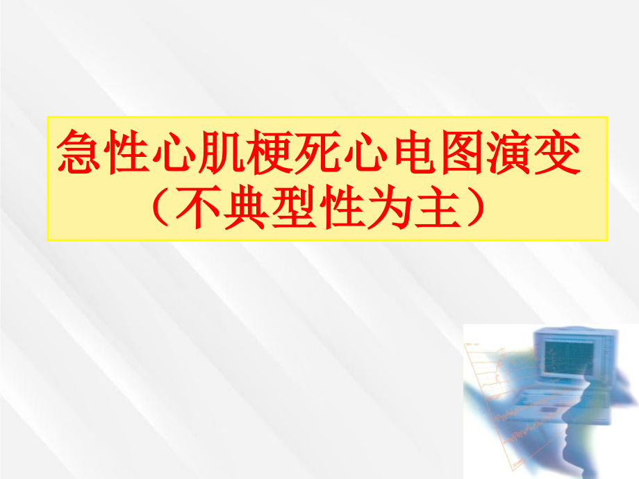 急性心肌梗死心电图演变_第1页