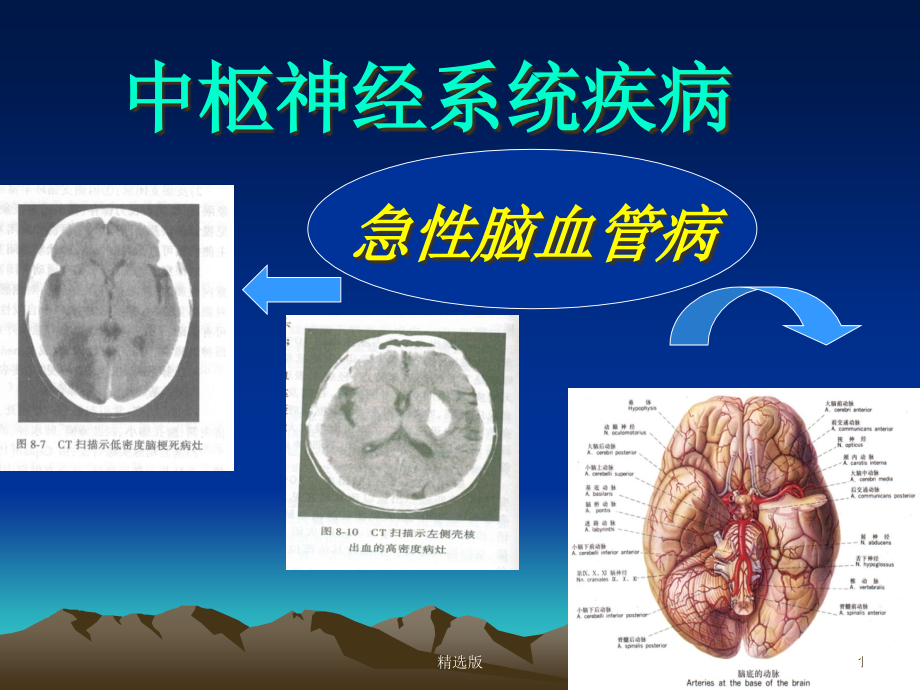 急性脑血管病ppt课件_第1页