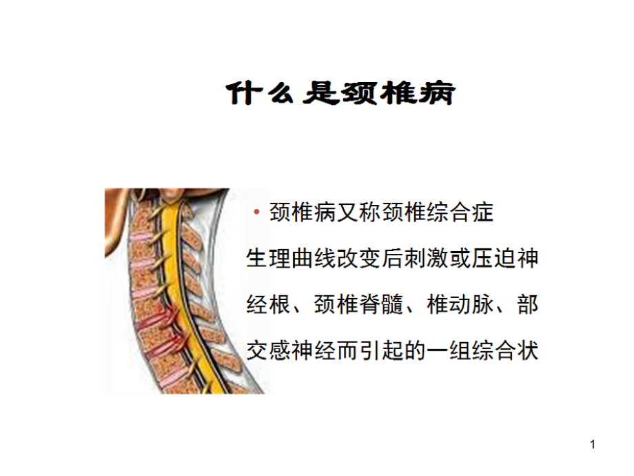 专家图解颈椎病的预防与保健课件_第1页