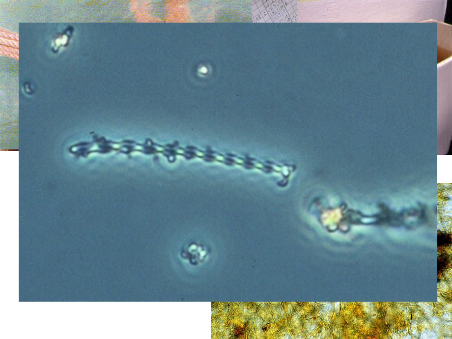 几种常见丝状菌专业知识讲座课件_第1页
