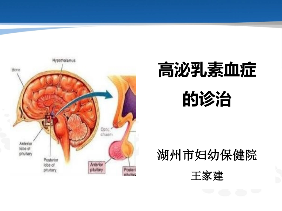 高泌乳素血症治疗课件_第1页