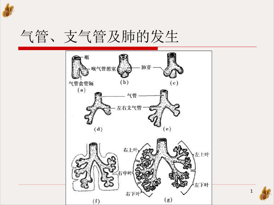 气管支气管及肺先天病变课件_第1页