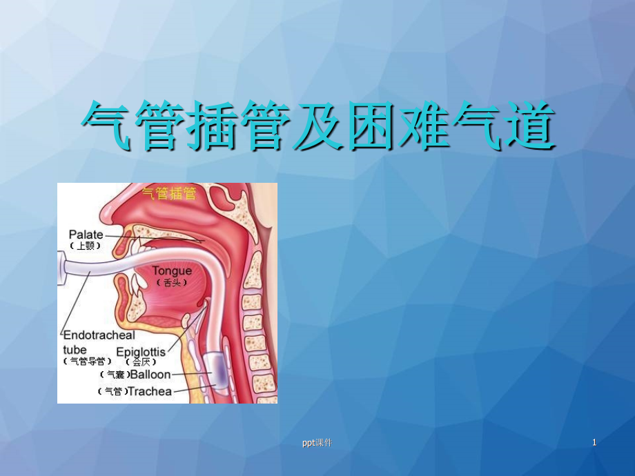 气管插管及困难气道--课件_第1页