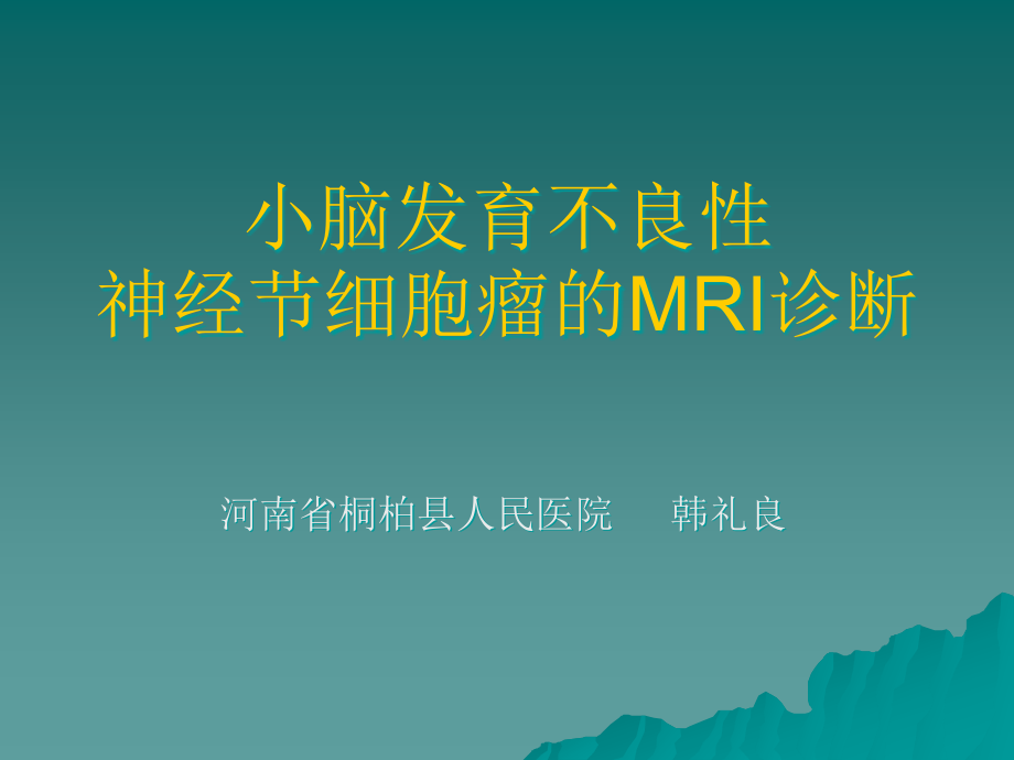 小脑发育不良性神经节细胞瘤的MRI表现课件_第1页