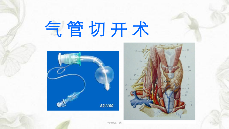 气管切开术课件_第1页