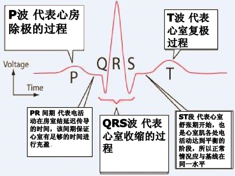 心律失常心电图课件_第1页