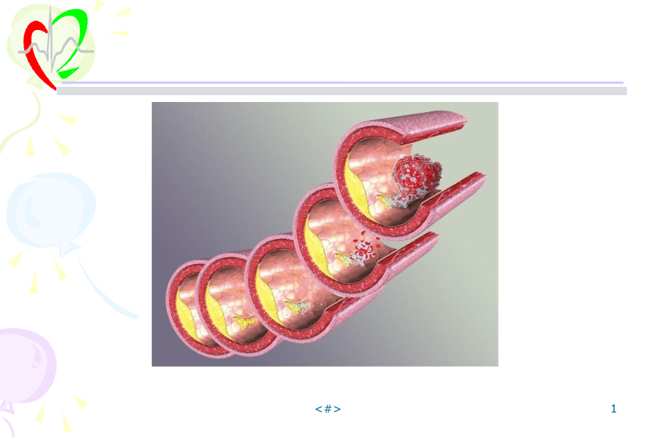 家族性纯合子型高胆固醇血症或动物模型由于巨噬细胞表面的LDL课件_第1页