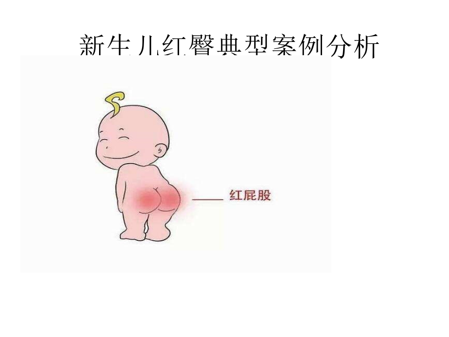 新生儿红臀案例分析课件_第1页