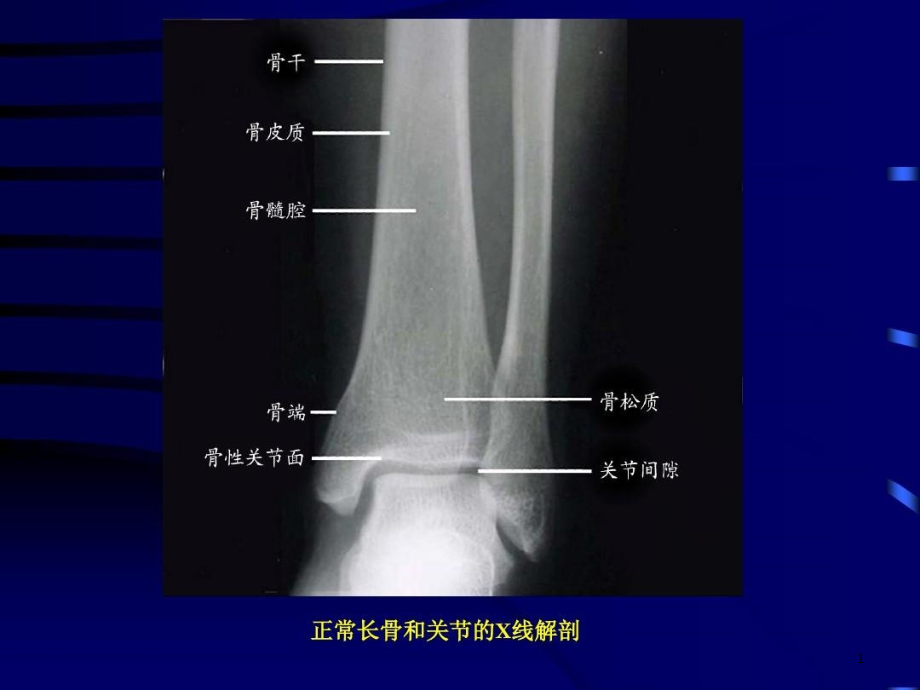 影像学骨关节实验课件_第1页