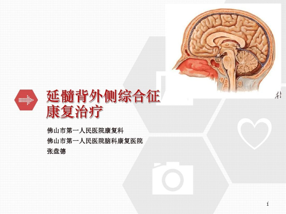 延髓背外侧综合征的康复治疗课件_第1页