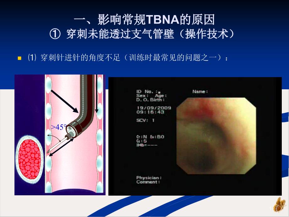 经支气管针吸活检技术操作事项培训课程课件_第1页