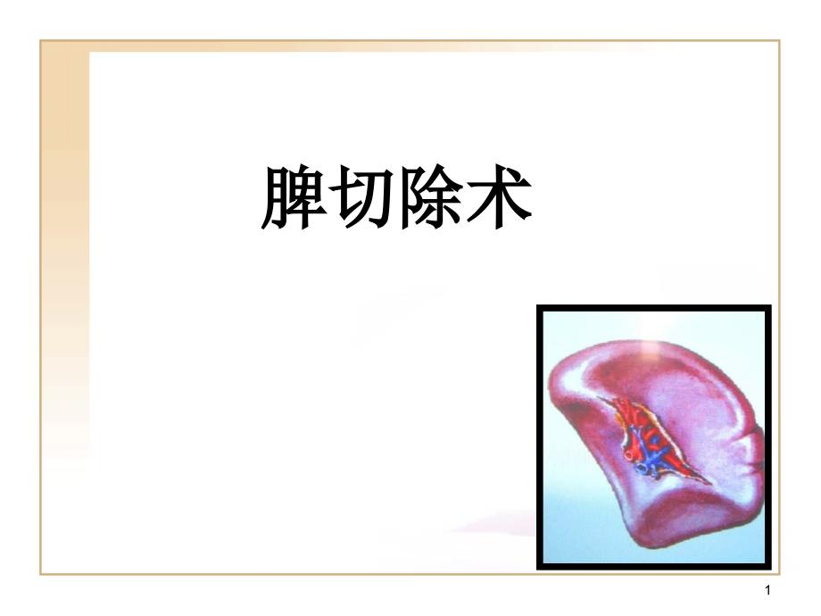 脾切除术课件_第1页