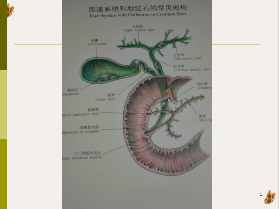 胆囊结石成因和治疗进展教材课件_第1页