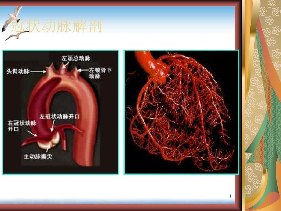 经桡动脉冠脉造影课件_第1页