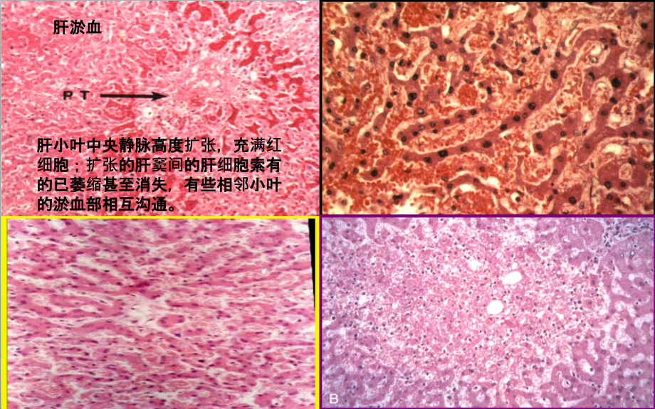 病理实验切片-附说明课件_第1页