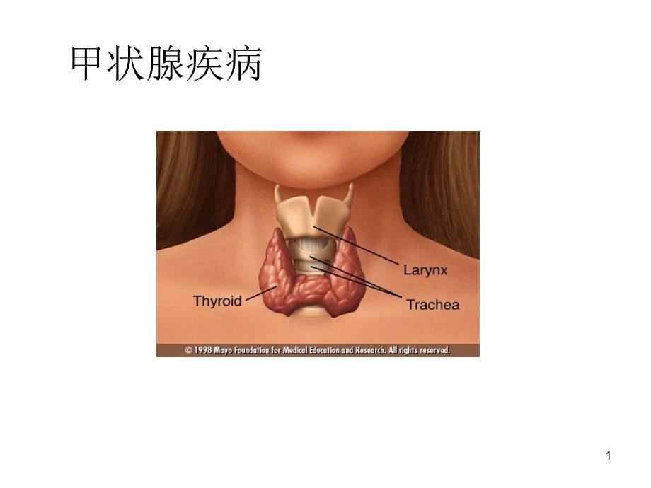 甲状腺疾病ppt课件_第1页