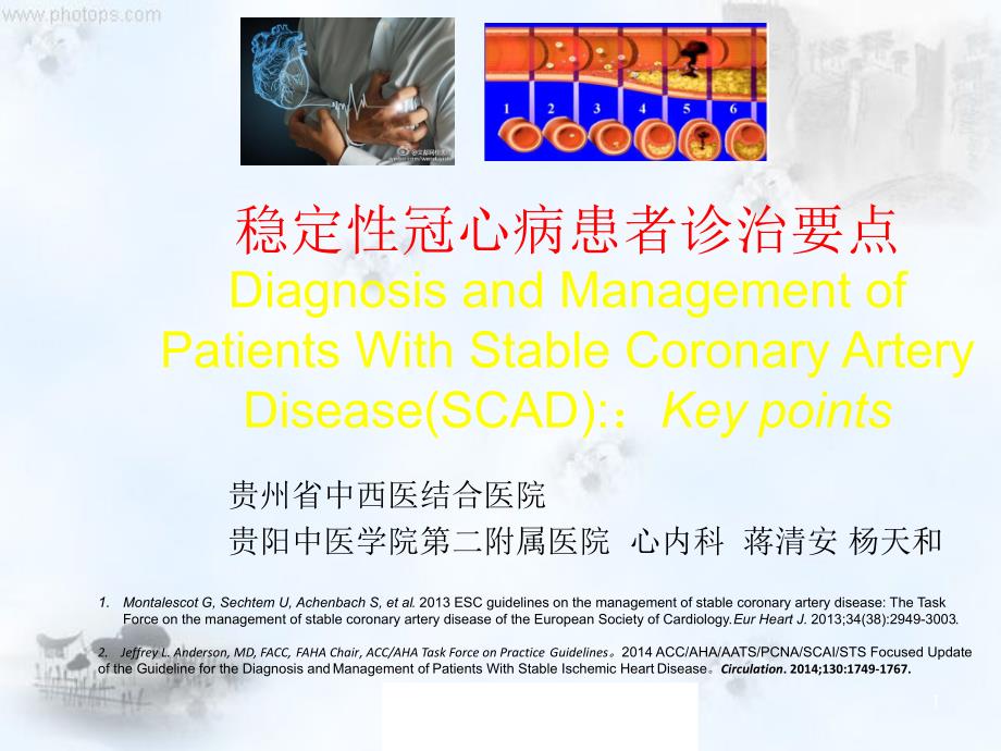 稳定性冠心病诊治要点课件_第1页