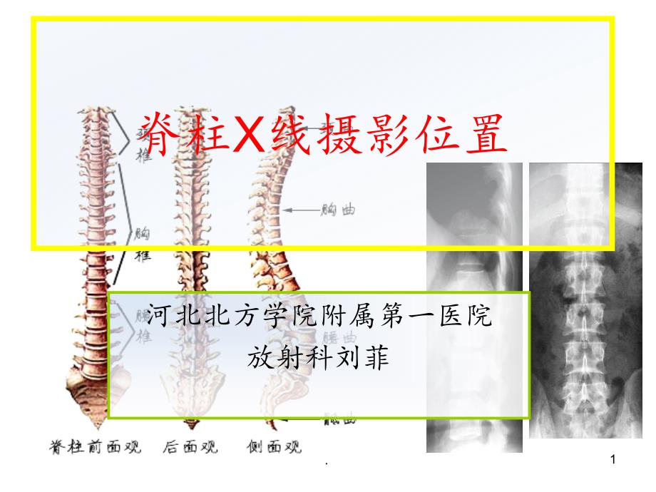 脊柱X线摄影技术课件_第1页