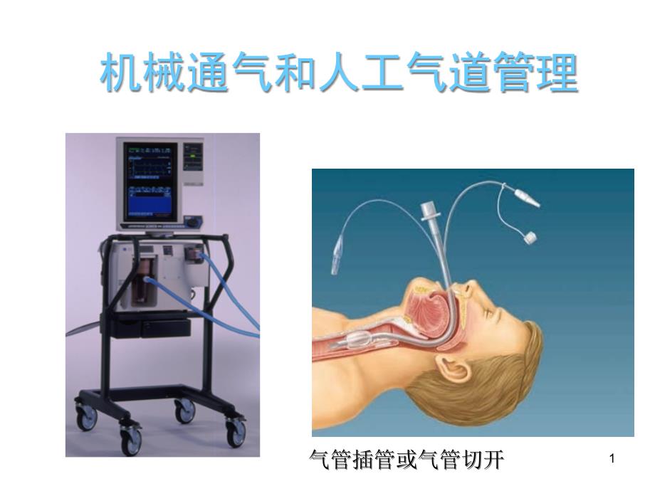 肺泡毛细血管膜结构课件_第1页