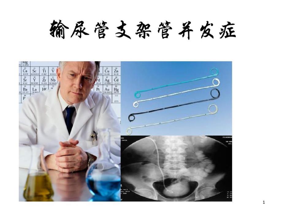 输尿管支架管并发症讲课教案课件_第1页