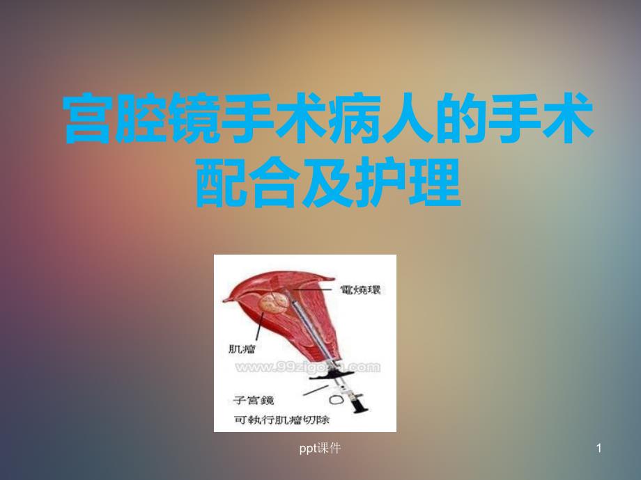 宫腔镜手术病人的手术配合及护理课件_第1页