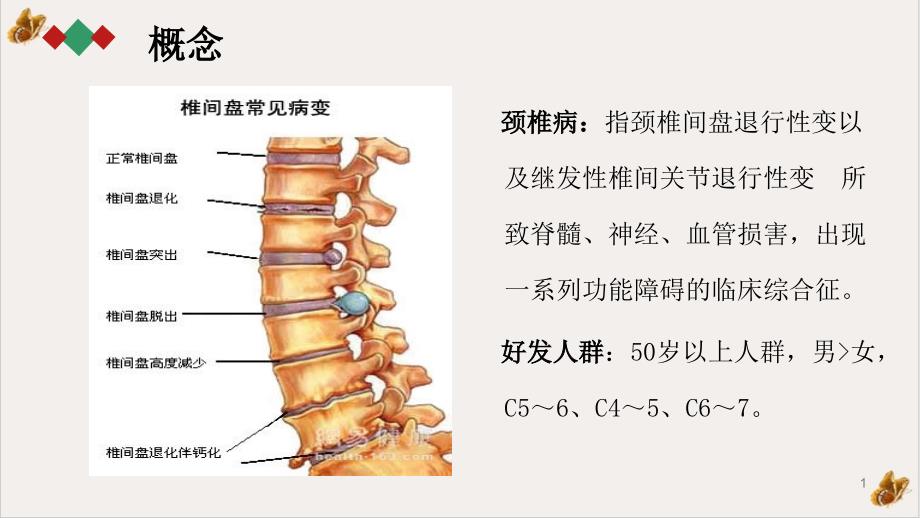 颈椎病的护理查房培训课件_第1页