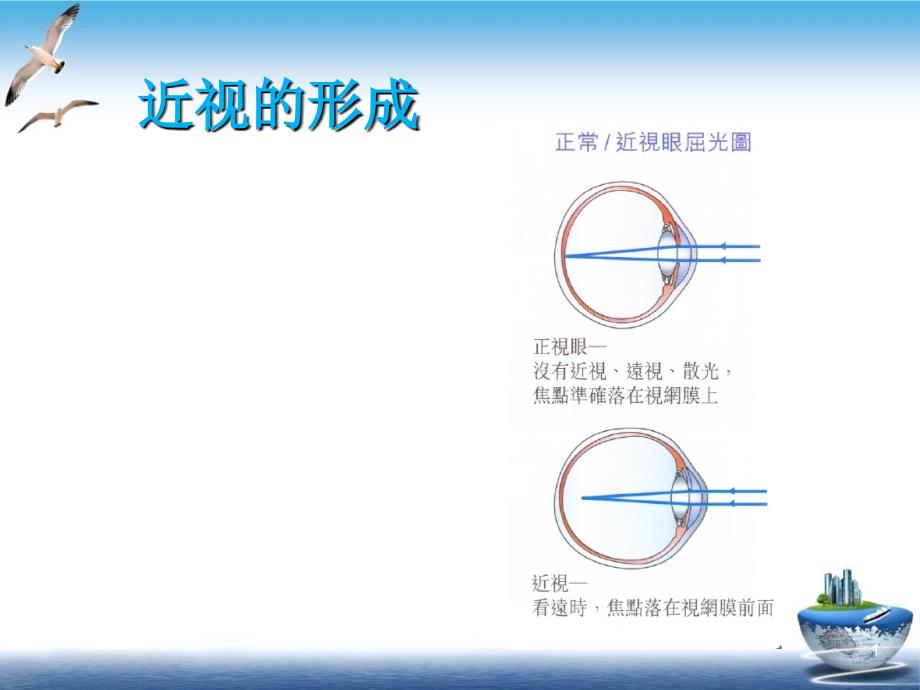 近视眼的防治课件_第1页