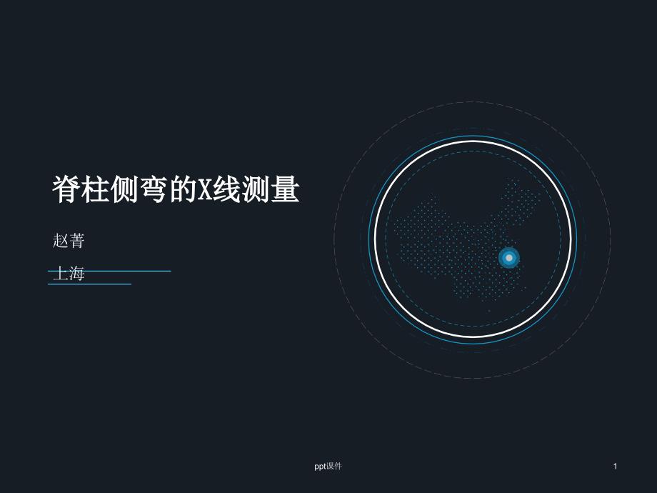 青少年特发性脊柱侧弯X线基本测量--课件_第1页