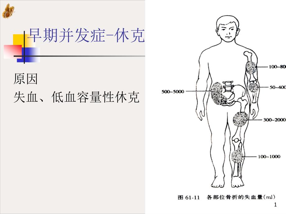 骨折并发症护理教材课件_第1页