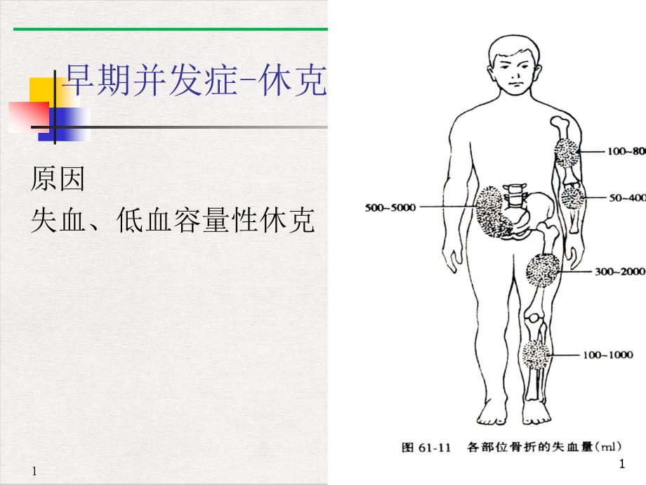 骨折并发症护理课件_第1页