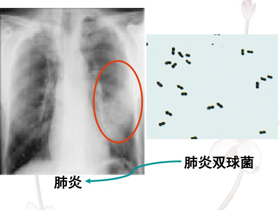 细菌的形态结构特点及繁殖方式_第1页