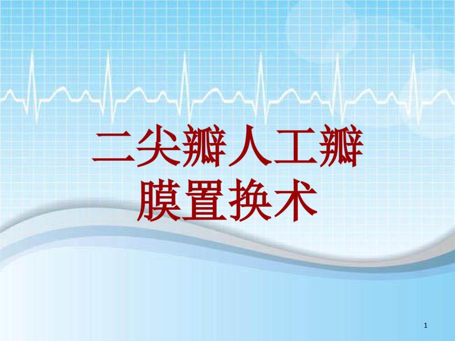 手术讲解模板：二尖瓣人工瓣膜置换术课件_第1页